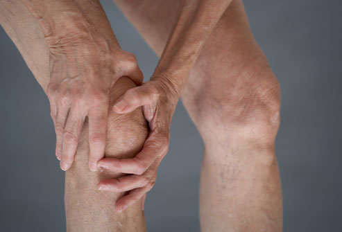 osteoarthritis symptoms